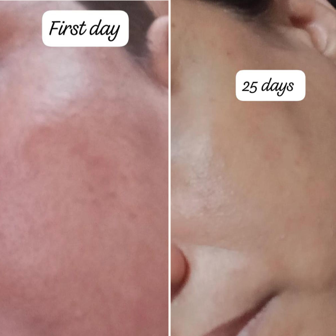 Hydra Whip Moisturizing Cream