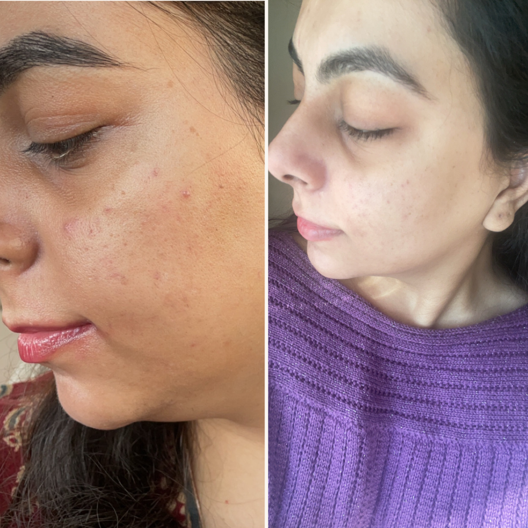 Encapsulated Retinol Night Cream