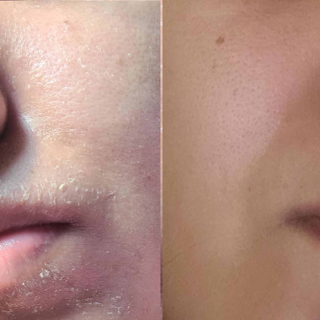 Hydra Whip Moisturizing Cream