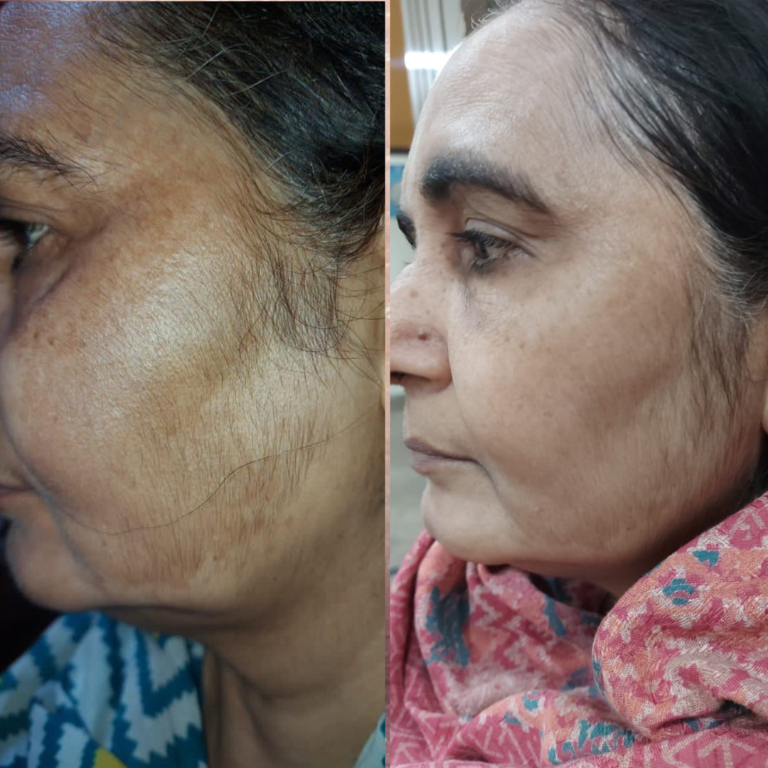 Encapsulated Retinol Night Cream